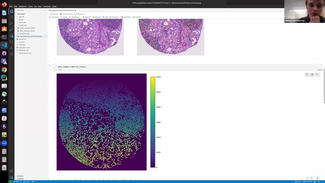 Introducing InstanSeg, a deep learning-based method for the segmentation of cells in brightfield