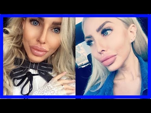 Polska żywa barbie ryzykuje zdrowie i życie dla urody! nie uwierzycie, czym powiększa swoje usta!