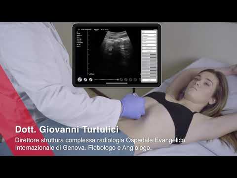 ECOGRAFIA GROSSI VASI