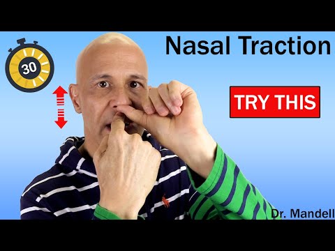 Nasal Traction...Clear Stuffy Nose & Sinuses | Created...
