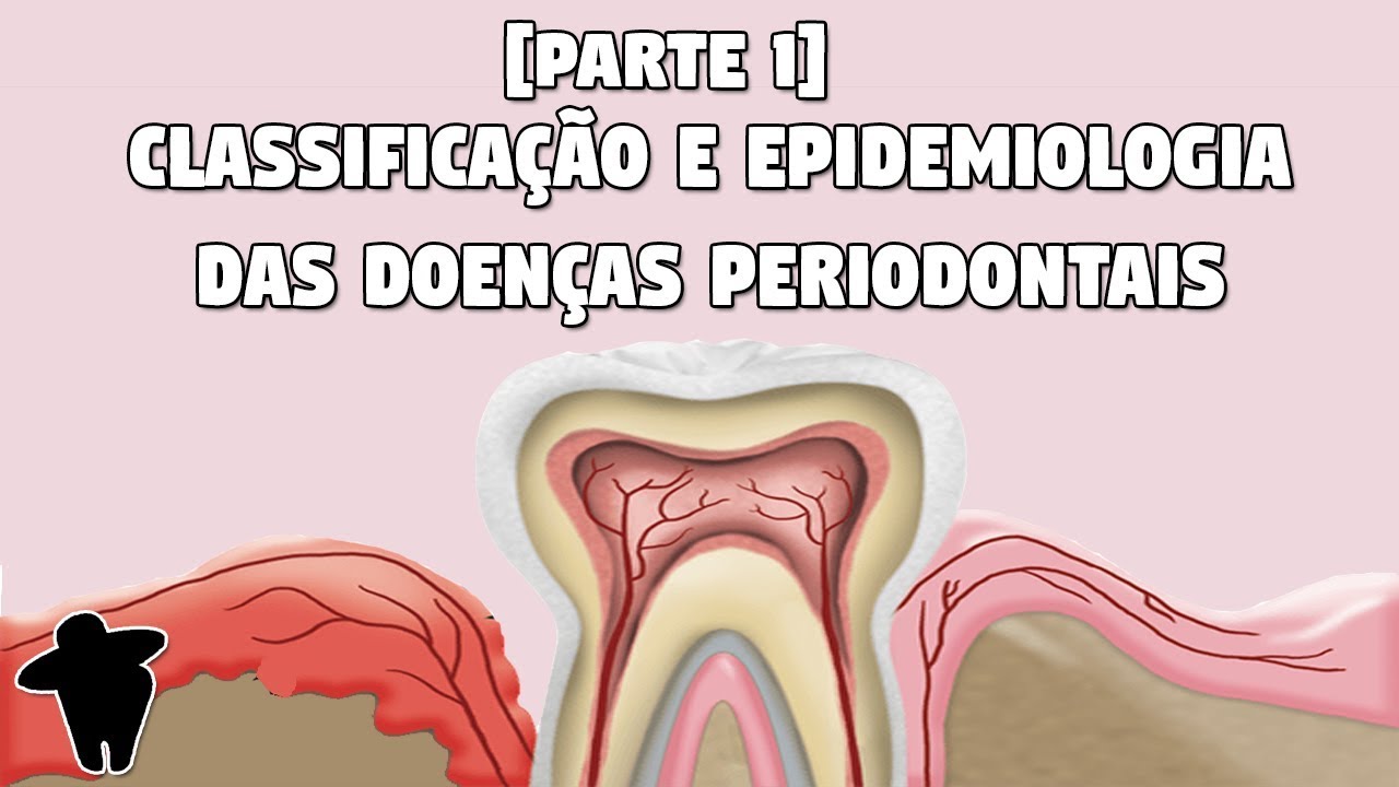 Classificação e Epidemiologia das Doenças Periodontais - Concursos Para Dentistas [DE #6 PT1]