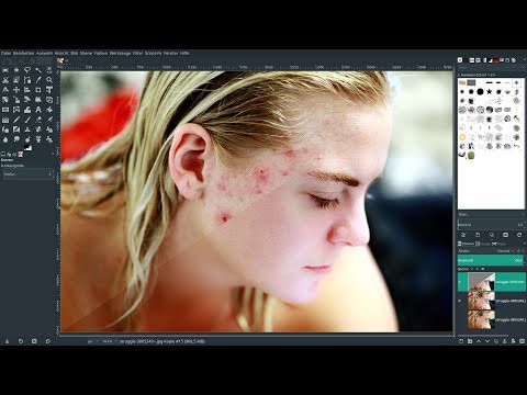 Superfilter GMIC und Gimp 2.10.8 - Akne retuschieren