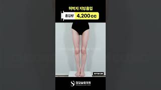 원래 얇았던 허벅지 과연 효과는..?