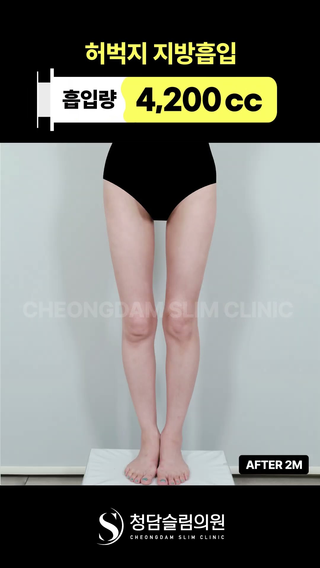 원래 얇았던 허벅지 과연 효과는..?