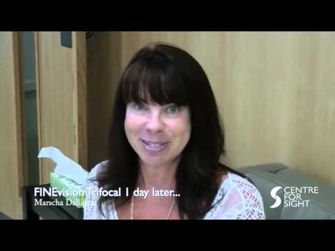 AMAZING! Trifocal lens Laser Lens replacement surgery - 1 day later…