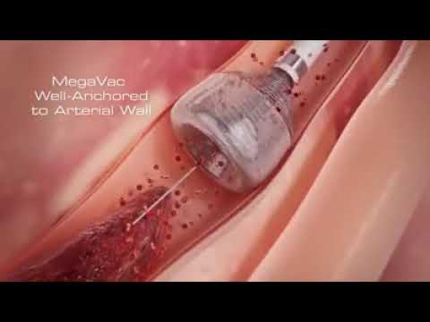 download lagu mp3 mp4 Jantung In English, download lagu Jantung In English gratis, unduh video klip Jantung In English