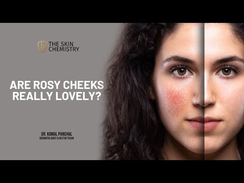 Are Rosy Cheeks really Lovely??