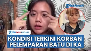 Kondisi Terkini Widya seusai Tragedi Pelemparan Batu di KA Sancaka yang Kena Pecahan Kaca