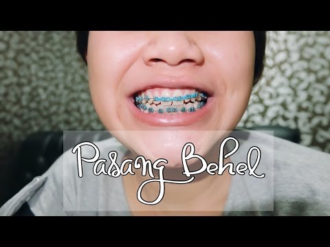 Patogen kuda dapat Anda beli di apotek Obat tradisional yang efektif untuk meningkatkan potensi