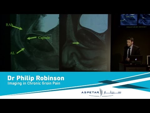 Imaging in Chronic Groin Pain by Dr Philip Robinson