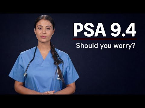 PSA 8, 9, or 10? What It Really Means (Before You Panic)