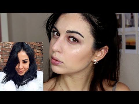 Il pigmentary nota il forum di persona La decolorazione da abbronzatura di crema