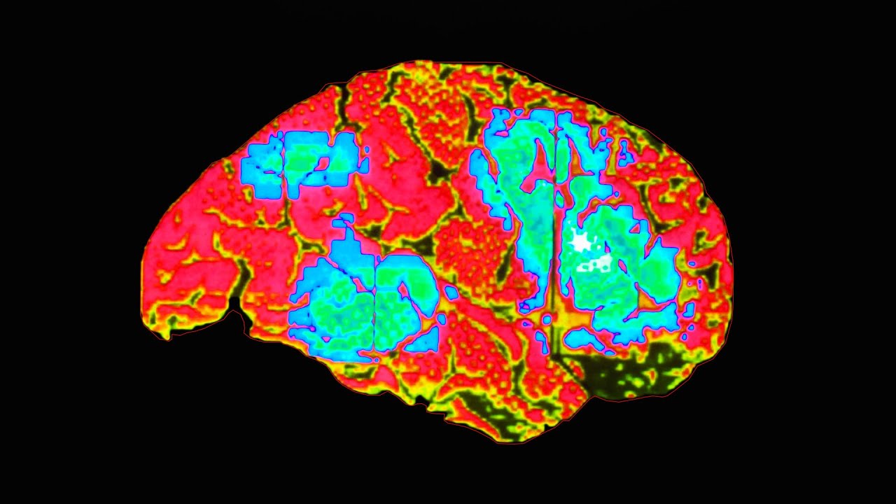 The Boy Who Rubbed 1 Tube Of Pain Relief Cream Between His Legs