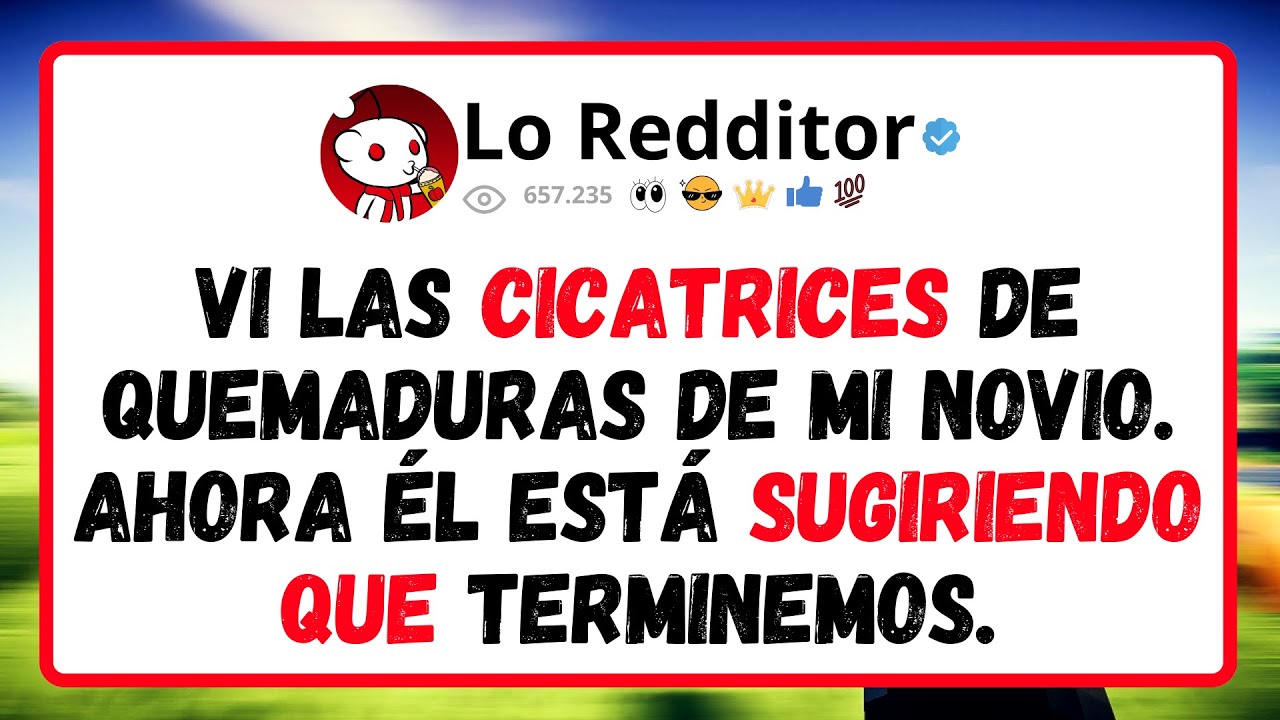 Vi Las Cicatrices De Quemaduras De Mi Novio. Ahora Él Está Sugiriendo Que Terminemos.