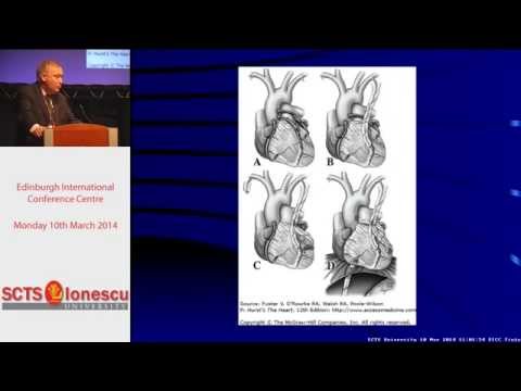 Complete revascularisation - evidence in CABG
