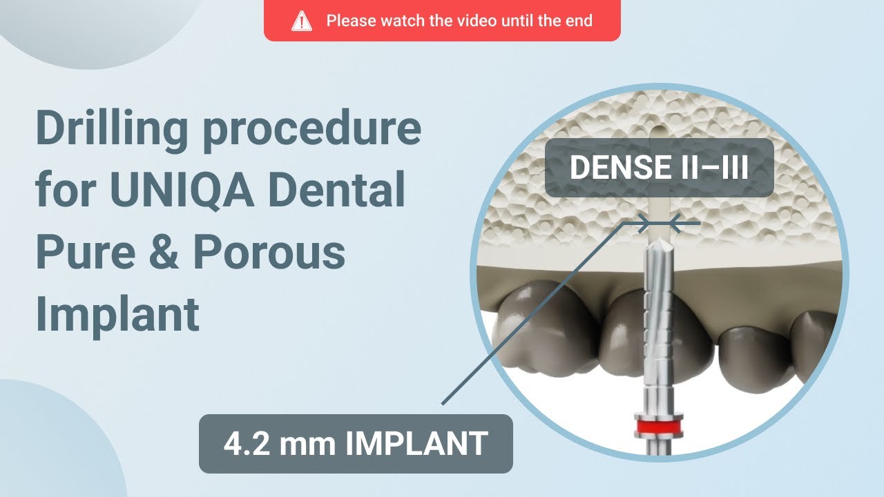 Drilling procedure for UNIQA Dental Pure & Porous Implant UH8 UV11 [ 4.2 mm | D2-D3 bone density ]