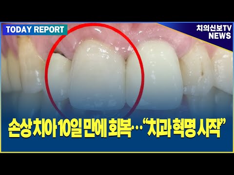 치약 바르기만 하면 상한 치아가 다시 자란다? (수정됨)