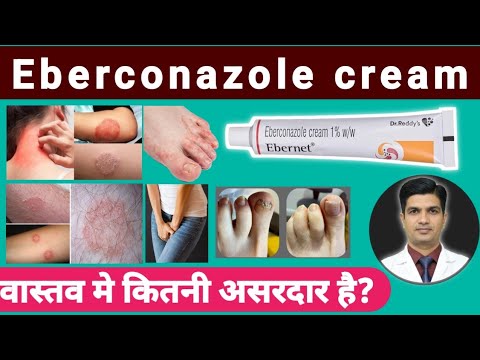 Eberconazole mometasone ebernet-m cream, 15 g