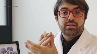 ¿Cuándo volver a hacer deporte después de un Trasplante Capilar