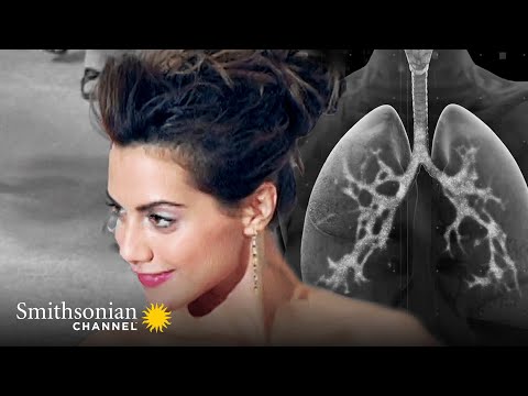 Why Brittany Murphy’s Pneumonia Was So Lethal | The Curious Life and Death of...