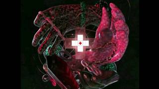 Ricky Remedy - Chosen (Feat. Diplo & Tunji Ige)