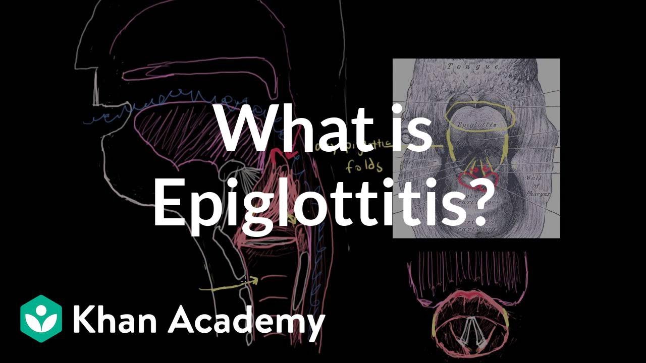 What is epiglottitis? | Respiratory system diseases | NCLEX-RN | Khan Academy - YouTube