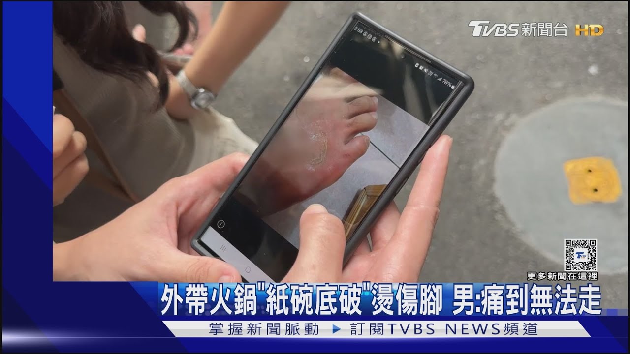 外帶火鍋「紙碗底破」燙傷腳男:痛到無法走