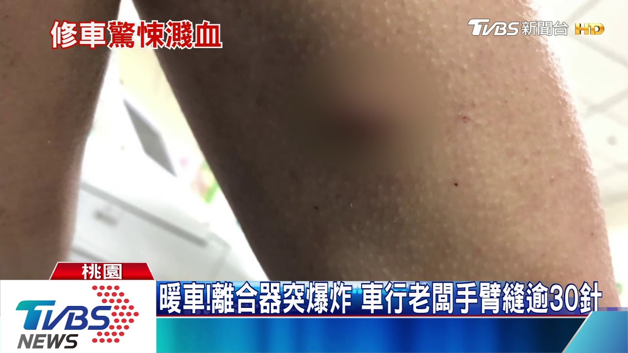 暖車！離合器突爆炸　車行老闆手臂縫逾30針