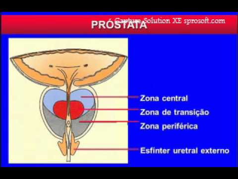 Tratamentul prostatitei inflamate