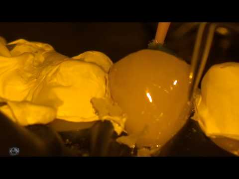 Adhesive cementation veneers and crowns with microscope by Anatoliy Tokar