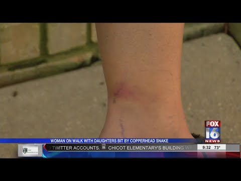 Woman on Walk with Daughter Bit by Copperhead Snake