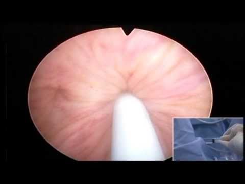 Wie heilen Prostatitis Bewertungen Prostata Ultraschall Preis Rostow am Don