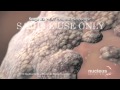 Cervical Cancer Staging