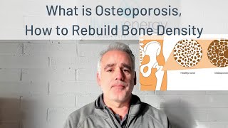 Osteoporosis - what it is, risk factors and strategies to build bone density