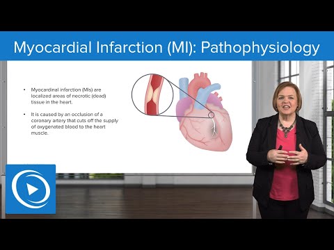 Myocardial Infarction (MI): Pathophysiology – Med-Surg Nursing | Lecturio Nursing