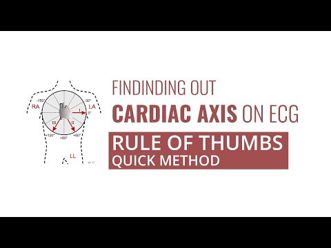 EKG Cardiac Axis | Rule of Thumbs