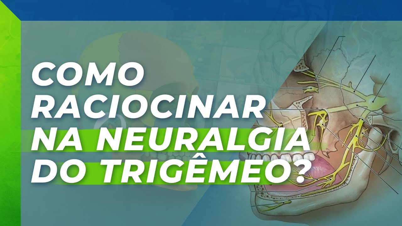 COMO RACIOCINAR NA NEURALGIA DO TRIGÊMEO