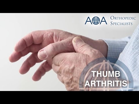 AOA Orthopedic Specialists - Dr. Cameron Atkinson - Thumb Arthritis