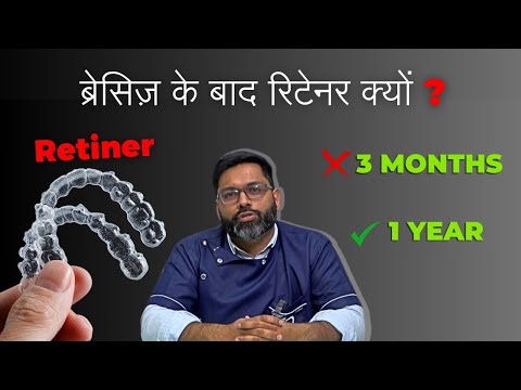 Why should I wear retainer after braces? #AskDentist
