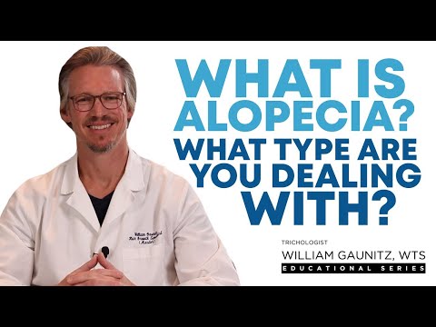 Alopecia Explained: What Is Alopecia? (Areata, Scarring, Androgenic, and other Hair Loss Types)