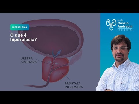 prostatitis a szuperhooling kezelésből
