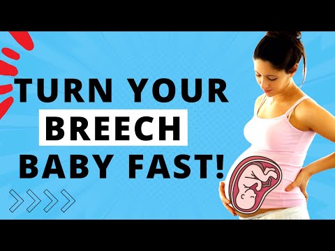 BEST SLEEPING POSITION TO TURN A BREECH BABY - THE ONLY SLEEPING POSITION TO RELIABLY TURN A BABY!