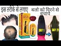 Sesa Hair Oil | Balo ko Jhadne Se Kese Roke | Best Hair Oil For Hair Growth | Best Oil |बालों के लिए