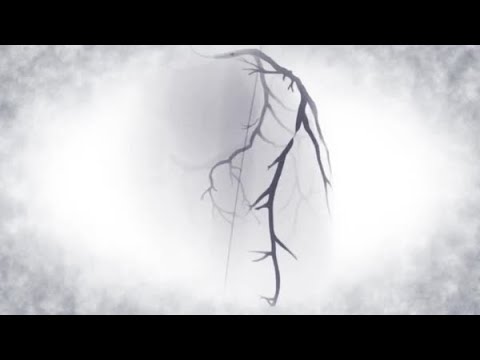 EBC MAIN: Reflection on the study in practical Left Main bifurcations cases