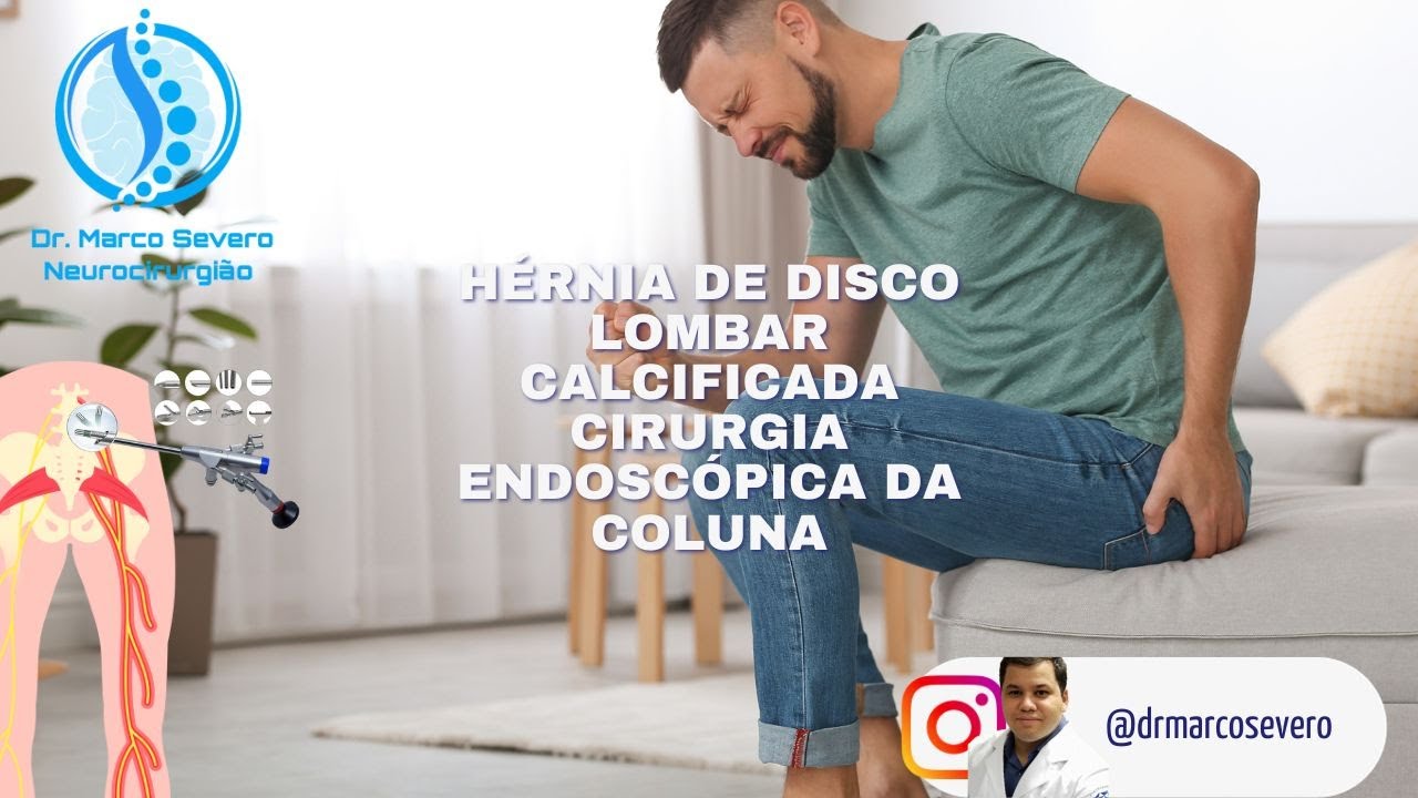 Marco Aurélio Severo Da Silva Versiani-66