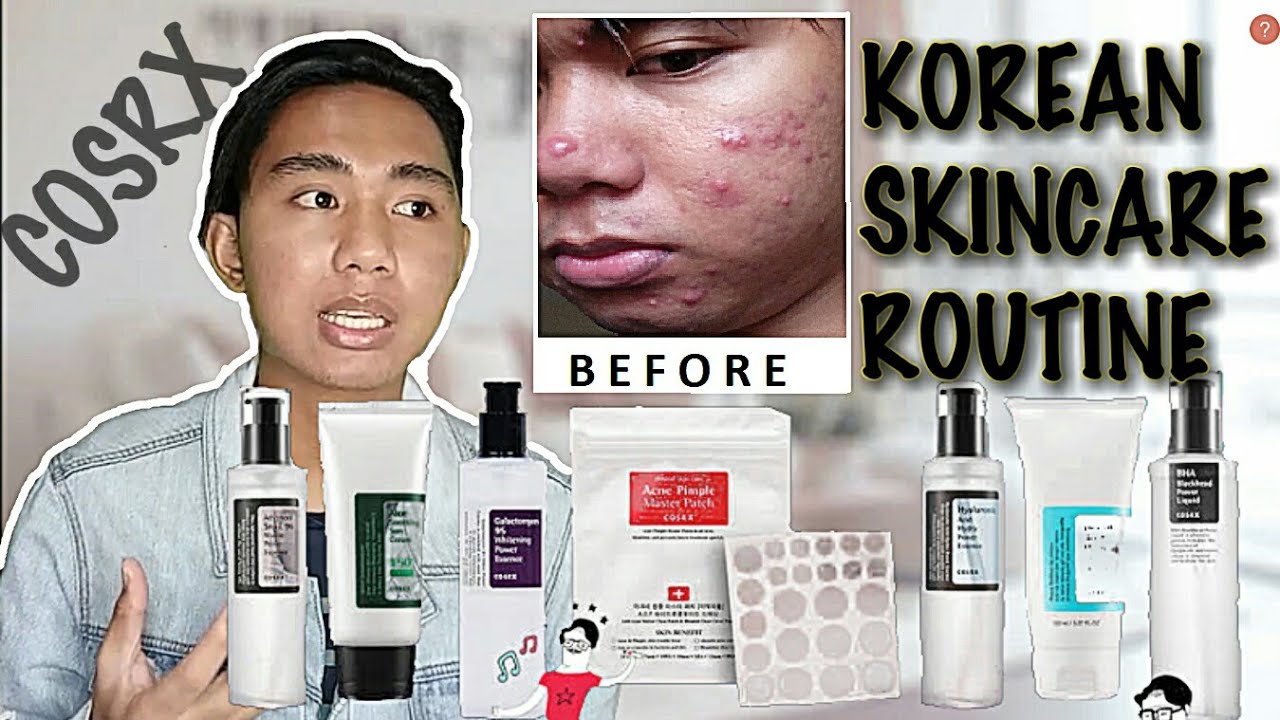 I Tried Korean Skincare Routine For 20 DAYS BEFORE and AFTER COSRX Products REVIEW Philippines