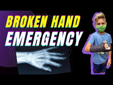 Broken Hand Emergency! || Another Broken Bone 🦴 😢