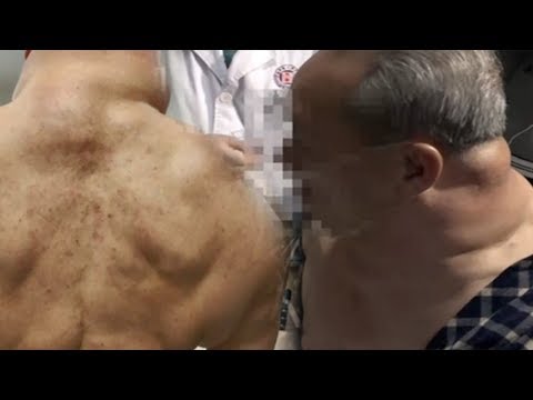Saya anggota martir kecil Diet peningkatan potensi