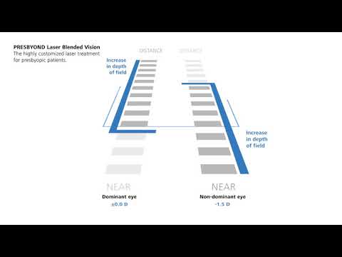 PRESBYOND Laser Blended Vision – The unique Blend Zone