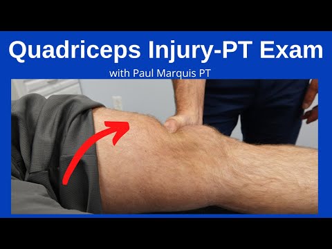 Modified Lachman s Test On a patient with a COMPLETE ACL TEAR